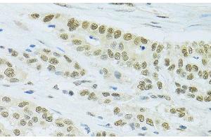 Immunohistochemistry (Paraffin-embedded Sections) (IHC (p)) image for anti-FIP1 Like 1 (FIP1L1) antibody (ABIN7263123)