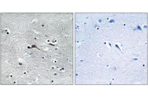 Immunohistochemistry analysis of paraffin-embedded human brain tissue, using CYTL1 Antibody.
