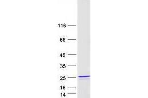 Western Blotting (WB) image for Zinc Finger Protein 580 (ZNF580) (Transcript Variant 3) protein (Myc-DYKDDDDK Tag) (ABIN2736075)
