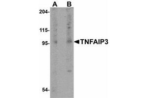Image no. 1 for anti-Tumor Necrosis Factor, alpha-Induced Protein 3 (TNFAIP3) (Internal Region) antibody (ABIN478080) (TNFAIP3 antibody  (Internal Region))