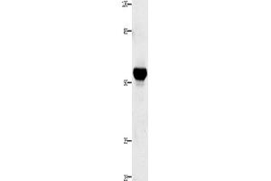 Western Blotting (WB) image for anti-Tumor Necrosis Factor Receptor Superfamily, Member 21 (TNFRSF21) antibody (ABIN2425779) (TNFRSF21 antibody)