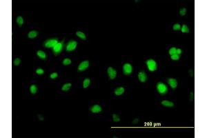 Immunofluorescence of monoclonal antibody to FBXL10 on HeLa cell. (KDM2B antibody  (AA 457-555))