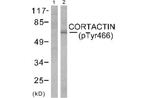 Western blot analysis of extracts from cos-7cells using Cortactin (phospho-Tyr466) antibody (Line 1 and 2). (Cortactin antibody  (pTyr466))