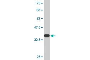 Western Blot detection against Immunogen (36. (Transferrin antibody  (AA 551-650))