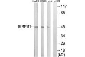 Western blot analysis of extracts from HeLa/COLO/HuvEc cells, using SIRPB1 Antibody.