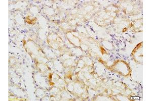 Formalin-fixed and paraffin embedded mouse kidney tissue labeled with Anti-MCKD2/UMOD Polyclonal Antibody, Unconjugated  at 1:200 followed by conjugation to the secondary antibody and DAB staining (Uromodulin antibody  (AA 351-450))