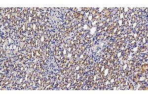 Detection of HIF1a in Rat Kidney Tissue using Polyclonal Antibody to Hypoxia Inducible Factor 1 Alpha (HIF1a) (HIF1A antibody  (AA 216-336))