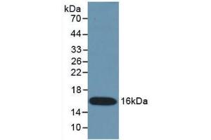 Detection of Recombinant IFNg, Mouse using Monoclonal Antibody to Interferon Gamma (IFNg) (Interferon gamma antibody  (AA 23-155))