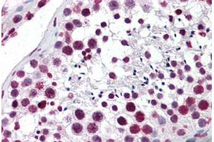 Human Testis: Formalin-Fixed, Paraffin-Embedded (FFPE) (Aryl Hydrocarbon Receptor antibody  (AA 279-376))