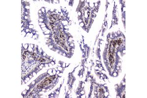 IHC analysis of GLO1 using anti-GLO1 antibody .