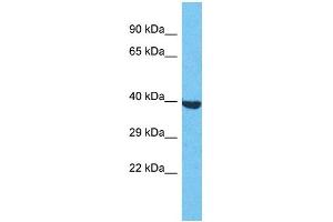 Western Blotting (WB) image for anti-Olfactory Receptor, Family 2, Subfamily S, Member 2 (OR2S2) (C-Term) antibody (ABIN2791727)