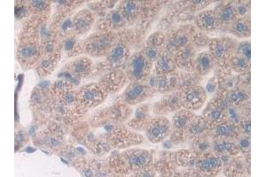 Detection of DDX58 in Mouse Liver Tissue using Polyclonal Antibody to Probable ATP-dependent RNA Helicase DDX58 (DDX58) (DDX58 antibody  (AA 1-211))