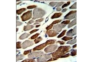 Formalin-fixed and paraffin-embedded human skeletal muscle with EMILIN1 Antibody (N-term), which was peroxidase-conjugated to the secondary antibody, followed by DAB staining. (Emilin1 antibody  (N-Term))