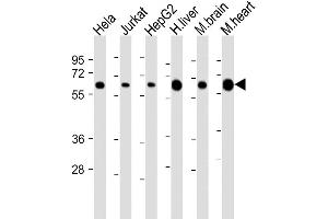 Western Blot at 1:2000 dilution Lane 1: Hela whole cell lysate Lane 2: Jurkat whole cell lysate Lane 3: HepG2 whole cell lysate Lane 4: human liver lysate Lane 5: mouse brain lysate Lane 6: mouse heart lysate Lysates/proteins at 20 ug per lane.