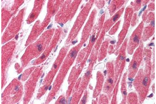 SERTAD1 antibody  (N-Term)