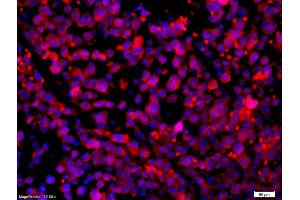 Formalin-fixed and paraffin-embedded mouse intestine carcinoma with Anti-CCR5/CD195 Polyclonal Antibody, Unconjugated (ABIN741375) 1:200, overnight at 4°C, The secondary antibody was Goat Anti-Rabbit IgG, Cy3 conjugated used at 1:200 dilution for 40 minutes at 37°C. (CCR5 antibody  (AA 201-300))