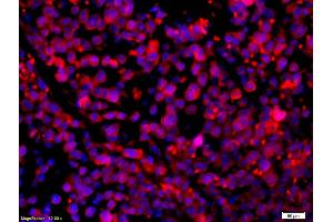 Formalin-fixed and paraffin-embedded mouse intestine carcinoma with Anti-CCR5/CD195 Polyclonal Antibody, Unconjugated (ABIN741375) 1:200, overnight at 4°C, The secondary antibody was Goat Anti-Rabbit IgG, Cy3 conjugated used at 1:200 dilution for 40 minutes at 37°C. (CCR5 antibody  (AA 201-300))