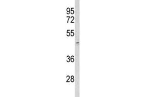 Western blot analysis of ACR antibody and human T47D lysate. (Acrosin antibody  (AA 99-127))