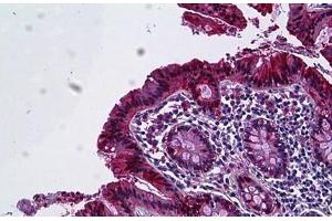 Human Colon, Epithelium: Formalin-Fixed, Paraffin-Embedded (FFPE) (Galectin 3 antibody  (AA 141-190))