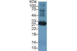 Western blot analysis of Rat Blood Cells lysate, using Rat TF Antibody (1 µg/ml) and HRP-conjugated Goat Anti-Rabbit antibody ( (Tissue factor antibody  (AA 30-252))