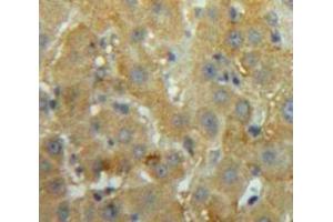#VALUE! (PTH antibody  (AA 32-115))