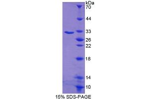 SDS-PAGE (SDS) image for C-terminal Binding Protein 1 (CTBP1) (AA 1-250) protein (His tag) (ABIN4989232) (CTBP1 Protein (AA 1-250) (His tag))