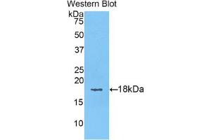 Western blot analysis of the recombinant protein. (KRT6A antibody  (AA 323-461))