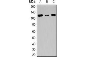Western blot analysis of TSHZ2 expression in HeLa (A), mouse heart (B), rat heart (C) whole cell lysates.