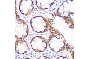 Immunohistochemistry of paraffin-embedded human colon using IGF2BP2/IGF2BP2/IMP2 Rabbit mAb (ABIN7267903) at dilution of 1:100 (40x lens). (IGF2BP2 antibody)