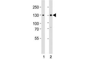 Western blot analysis of lysate from (1) 293 and (2) Jurkat cell line using GLI2 antibody at 1:1000. (GLI2 antibody  (C-Term))