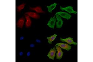 ABIN6258428 and ABIN6275047 staining Hela cells by IF/ICC.