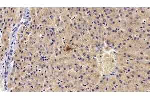 Detection of TEC in Porcine Liver Tissue using Polyclonal Antibody to Tec Protein Tyrosine Kinase (TEC) (Tec Protein Tyrosine Kinase (TEC) (AA 370-623) antibody)