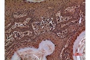 Immunohistochemistry (IHC) image for anti-serpin Peptidase Inhibitor, Clade A (Alpha-1 Antiproteinase, Antitrypsin), Member 3 (SERPINA3) (Internal Region) antibody (ABIN6287251)