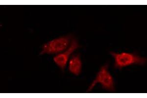 ABIN6267468 staining NIH-3T3 by IF/ICC. (CDC25B antibody  (pSer353))