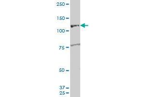 ARHGEF1 polyclonal antibody (A01), Lot # 060726QCS1 Western Blot analysis of ARHGEF1 expression in K-562 . (ARHGEF1 antibody  (AA 830-927))