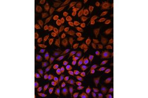 Immunofluorescence analysis of L929 cells using PDP1 Rabbit pAb (ABIN7269774) at dilution of 1:100. (PDP antibody  (AA 72-260))