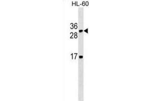 Western Blotting (WB) image for anti-Lymphotoxin beta (TNF Superfamily, Member 3) (LTB) antibody (ABIN2995416) (LTB antibody)