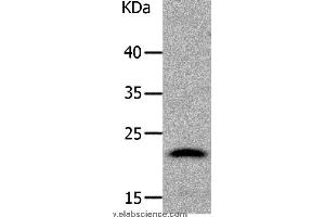 Western blot analysis of Human liver cancer tissue, using LCN2 Polyclonal Antibody at dilution of 1:1050 (Lipocalin 2 antibody)
