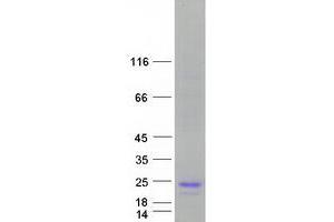 Validation with Western Blot
