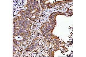 IHC analysis of Septin 2/SEPTIN2 using anti-Septin 2/SEPTIN2 antibody (ABIN7599275).
