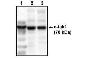Image no. 1 for anti-MAP/microtubule Affinity-Regulating Kinase 3 (MARK3) antibody (ABIN264979) (MARK3 antibody)