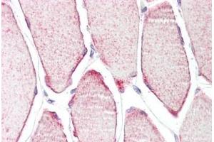 Human Skeletal Muscle: Formalin-Fixed, Paraffin-Embedded (FFPE) (TRIM54 antibody  (AA 388-400))