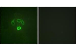 Immunofluorescence analysis of HepG2 cells, using GRB10 (Phospho-Tyr67) Antibody. (GRB10 antibody  (pTyr67))
