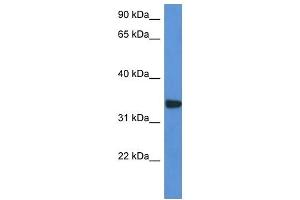 Western Blot showing HCCS antibody used at a concentration of 1 ug/ml against HepG2 Cell Lysate (HCCS antibody  (C-Term))