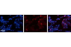 Rabbit Anti-GPX3 Antibody     Formalin Fixed Paraffin Embedded Tissue: Human Lung Tissue  Observed Staining: Membrane and cytoplasmic in alveolar type I & II cells  Primary Antibody Concentration: 1:100  Other Working Concentrations: 1/600  Secondary Antibody: Donkey anti-Rabbit-Cy3  Secondary Antibody Concentration: 1:200  Magnification: 20X  Exposure Time: 0. (GPX3 antibody  (N-Term))