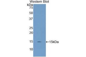 Western Blotting (WB) image for anti-Uncoupling Protein 2 (Mitochondrial, Proton Carrier) (UCP2) (AA 99-216) antibody (ABIN3205056)