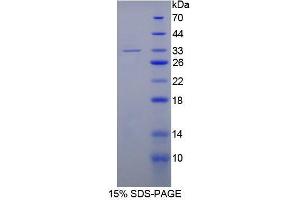 SDS-PAGE analysis of Human Topoisomerase II Protein. (TOP2 Protein)