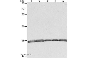 Western blot analysis of Hela, 293T and MCF7 cell, human fetal brain tissue and Jurkat cell, using PRDX3 Polyclonal Antibody at dilution of 1:800 (Peroxiredoxin 3 antibody)