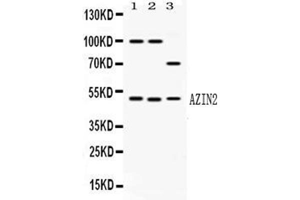 ADC antibody  (AA 111-301)