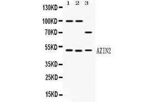 Western blot analysis of AZIN2 expression in rat brain extract ( Lane 1), mouse brain extract ( Lane 2) and HELA whole cell lysates ( Lane 3). (ADC antibody  (AA 111-301))